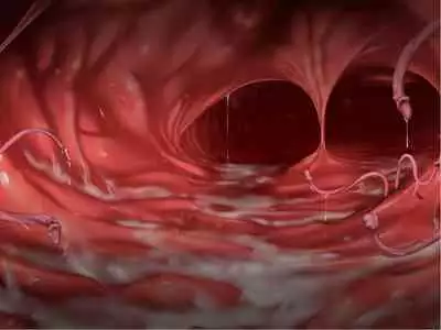 [Courreges Accel] Senkou no Ikusu -Disorder Eclipse- | 生物兵器战姬 伊克斯 [Chinese] [机翻汉化]